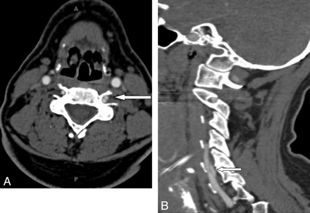 Fig 2.