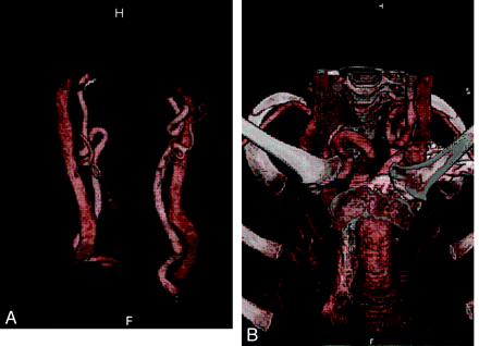 Fig 3.
