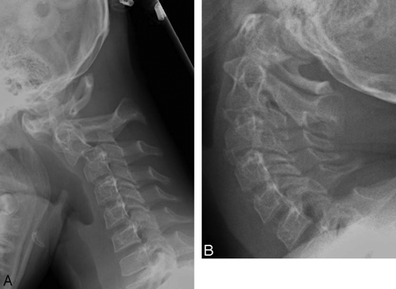 Fig 5.