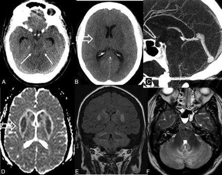 Fig 4.