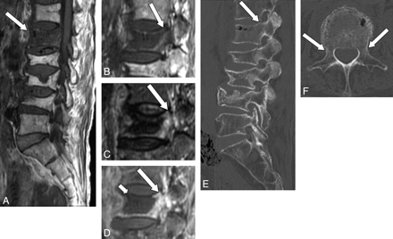 Fig 3.