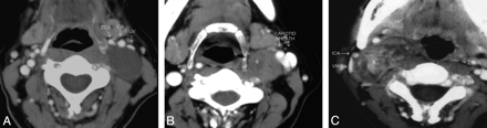 Fig 1.