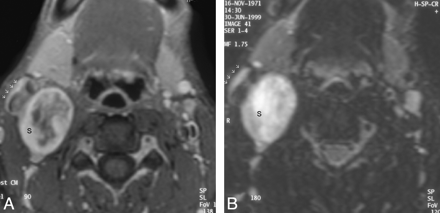 Fig 2.
