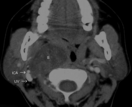 Fig 3.