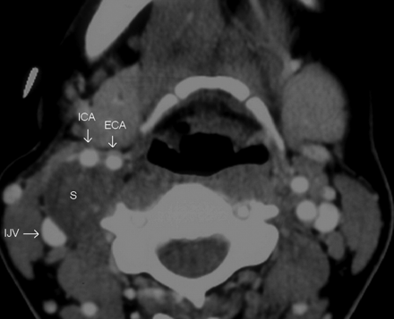 Fig 4.