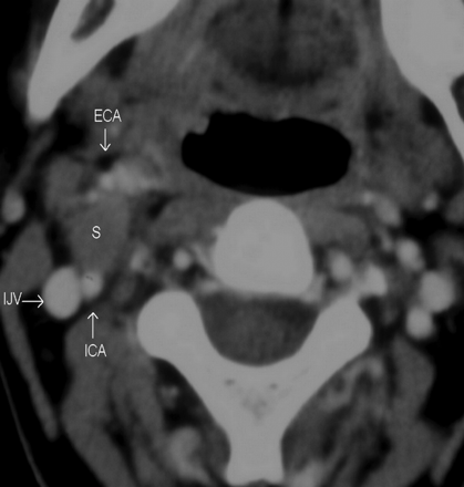 Fig 5.
