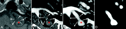 Fig 2.