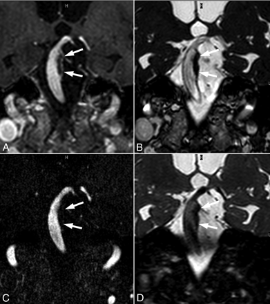 Fig 4.