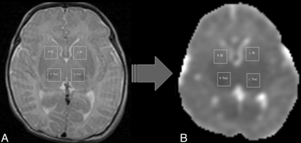 Fig 1.