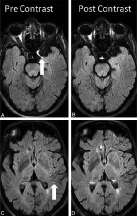 Fig 1.