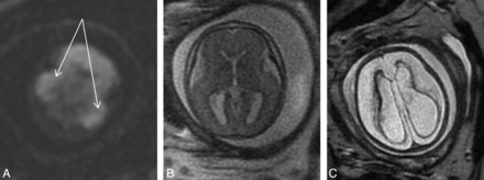 Fig 2.