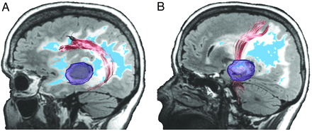 Fig 3.