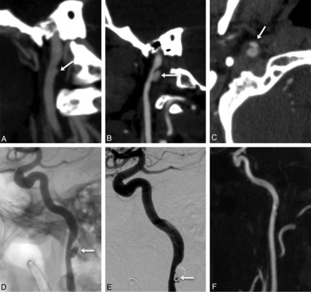 Fig 4.