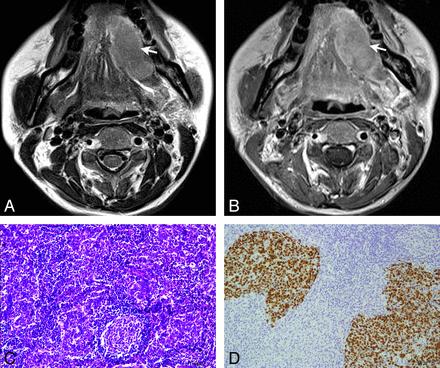 Fig 3.