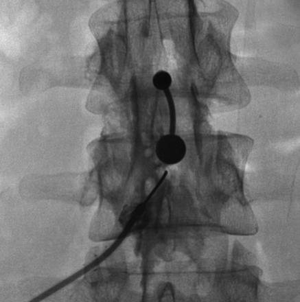 Fig 1.