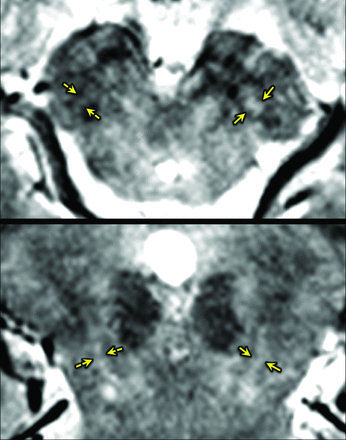 Fig 3.