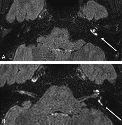 Fig 4.