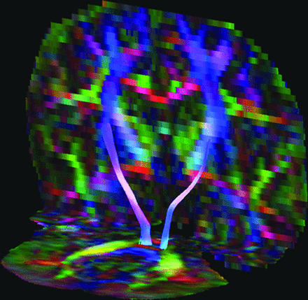 Fig 2.