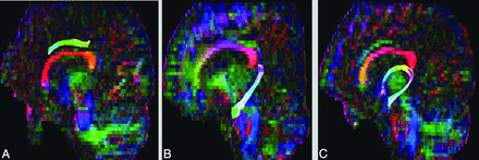 Fig 3.