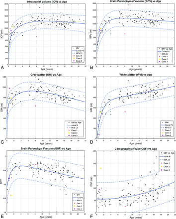 Fig 3.