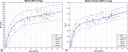Fig 3.
