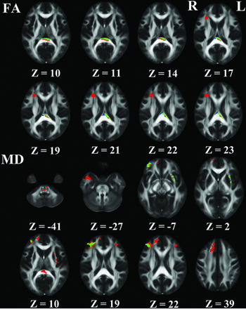 Fig 3.