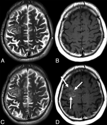 Fig 3.