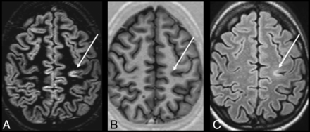 Fig 4.
