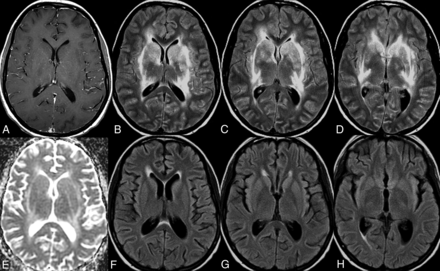 Fig 2.