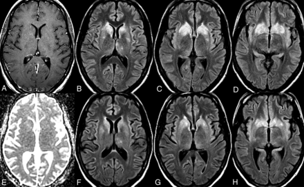Fig 3.