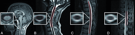 Fig 1.