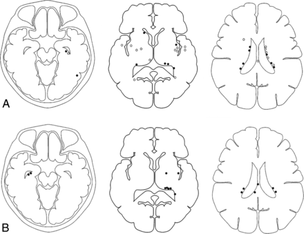 Fig 3.