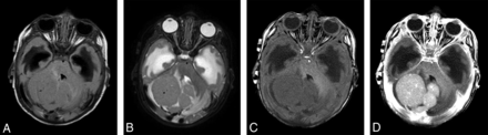 Fig 2.