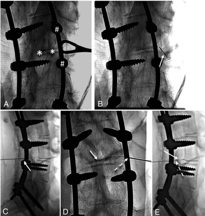 Fig 2.