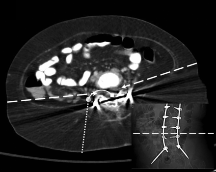 Fig 4.