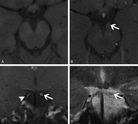 FIG 6.