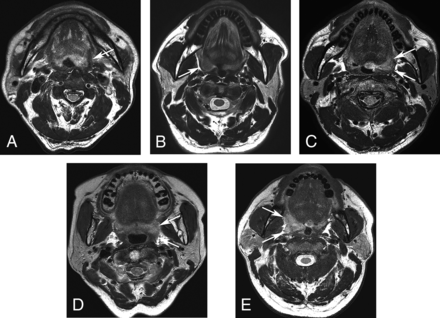 FIG 1.