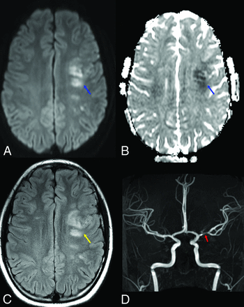 FIG 1.