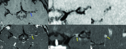 FIG 2.