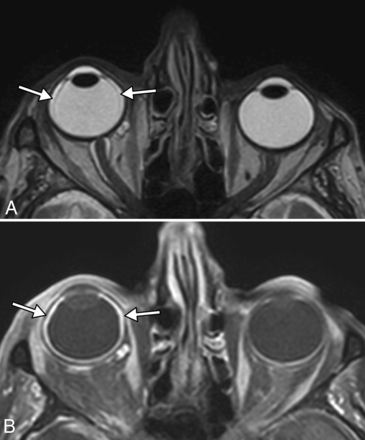 FIG 1.