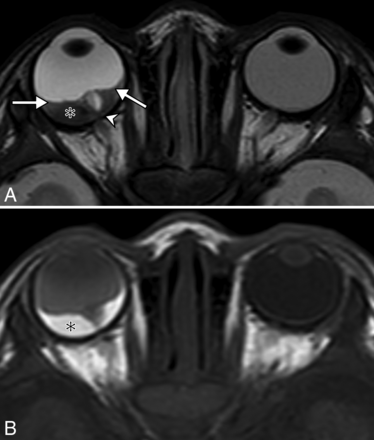 FIG 2.
