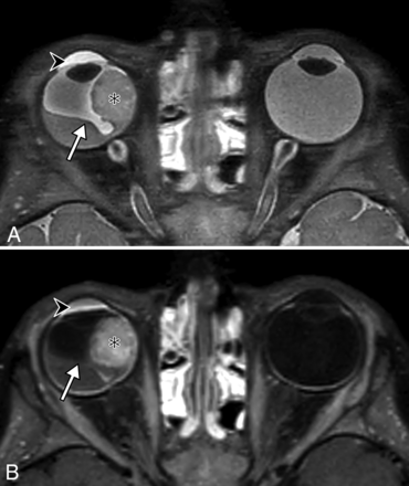 FIG 3.