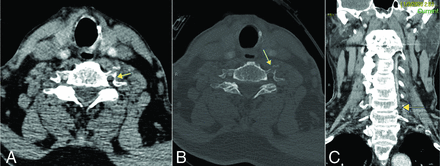 FIG 2.