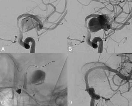 FIG 3.