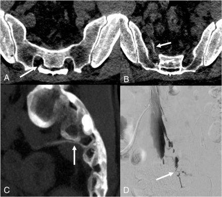 FIG 2.