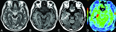 FIG 1.