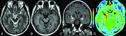 FIG 2.