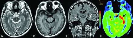 FIG 3.