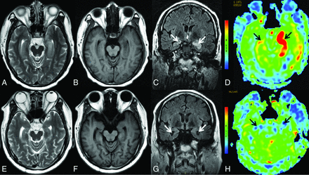 FIG 4.