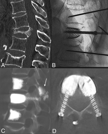 FIG 3.